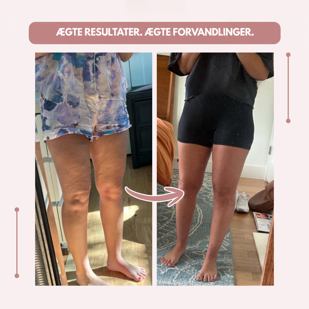 Før-og-efter-spejlbilleder af en kvindes ben, hvor efter-billedet viser slankere ben i sorte shorts. 19
