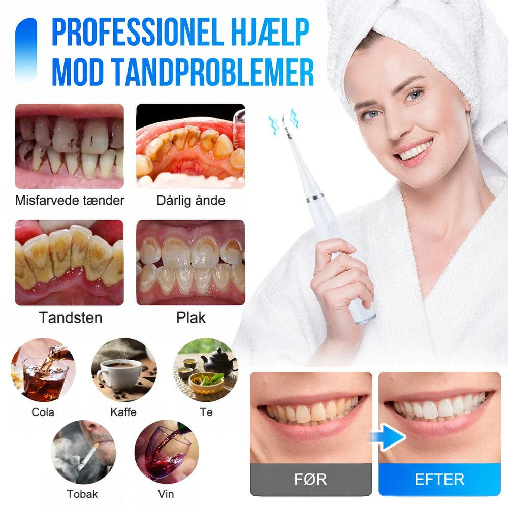 Collage med tandproblemer som misfarvninger, tandsten og plak samt før-og-efter-billede af smil, og en kvinde i badekåbe med den hvide tandrenser. 2